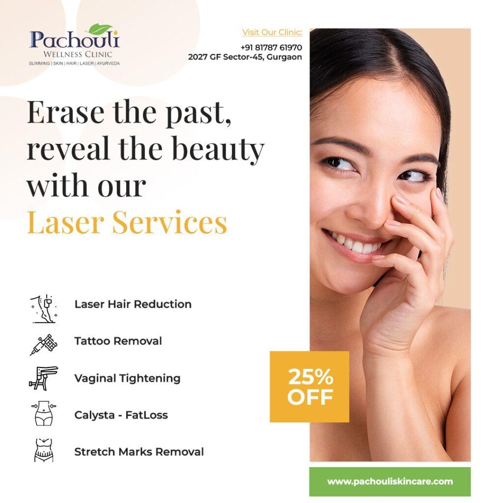 Laser Hair Removal Treatment