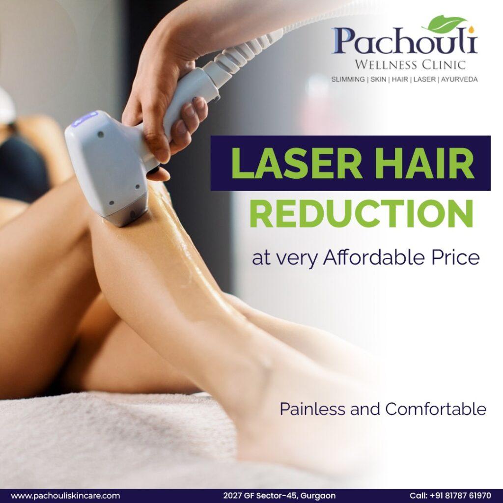 Laser Hair Treatment In Gurugram